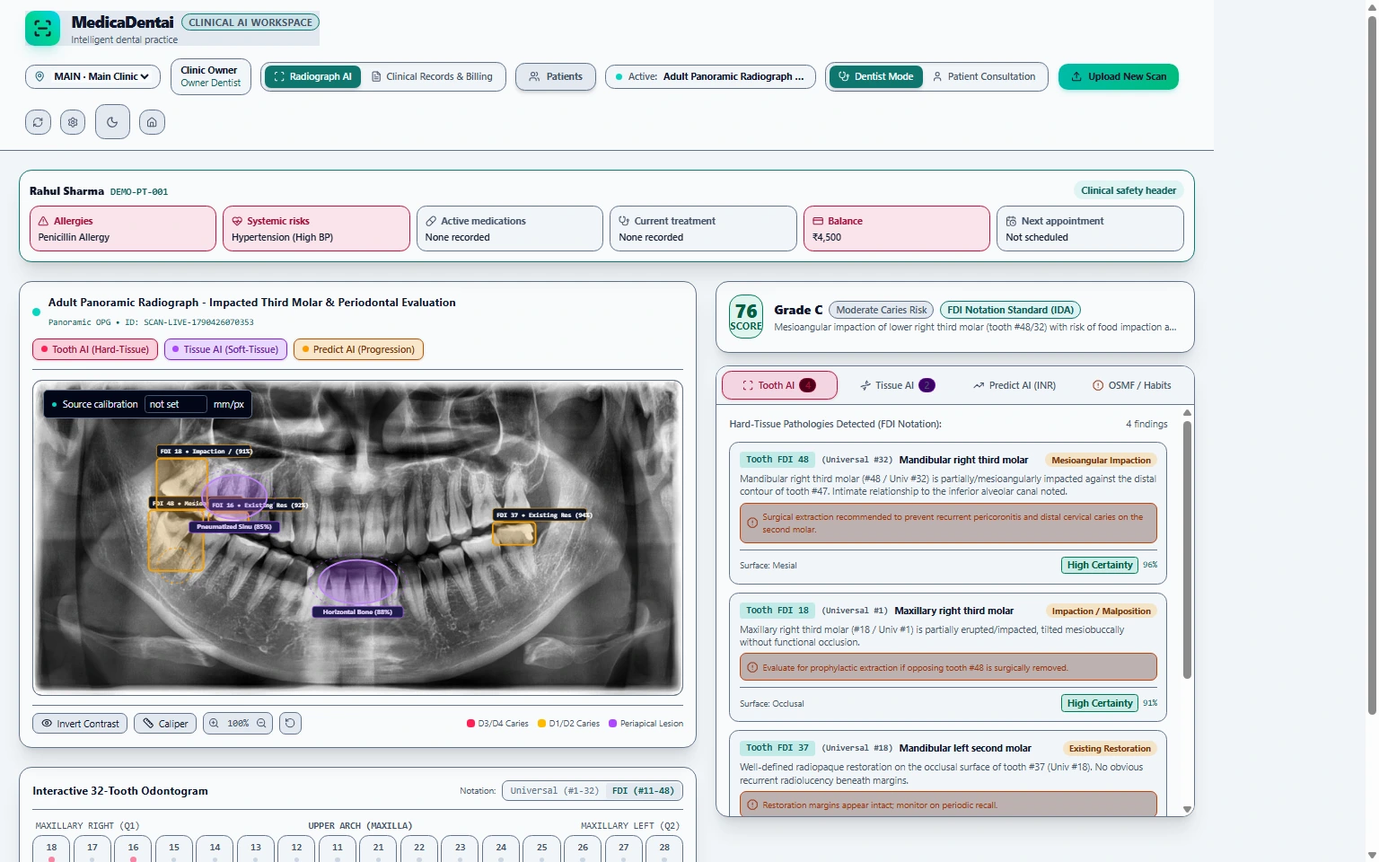 Actual MedicaDentai clinician output for the supplied panoramic radiograph, with image annotations, structured findings, confidence values, and odontogram