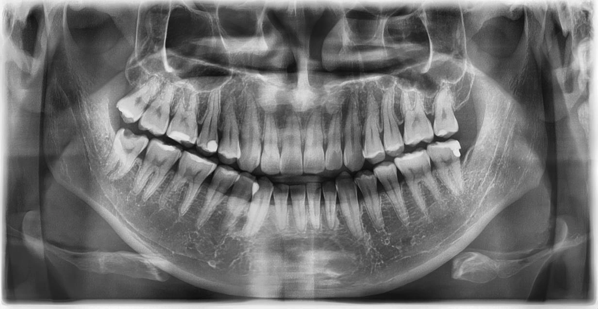 Supplied panoramic dental radiograph used for the live MedicaDentai demonstration